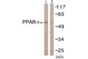 Western blot analysis of extracts from HuvEc cells, using PPAR-gamma (Ab-112) Antibody.