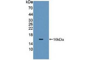 Figure. (CYP11A1 antibody  (AA 392-521))
