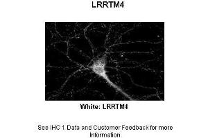 Sample Type :  Rat Hippocampal Neurons - 14DIV  Primary Antibody Dilution :  1:200  Secondary Antibody :  Anti-rabbit-Cy3  Secondary Antibody Dilution :  1:500  Color/Signal Descriptions :  White: LRRTM4  Gene Name :  LRRTM4  Submitted by :  Dan Fowler - University of Oregon, Institute of Neuroscience (LRRTM4 antibody  (Middle Region))