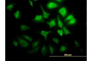 Immunofluorescence of monoclonal antibody to CCNG2 on HeLa cell. (Cyclin G2 antibody  (AA 1-344))