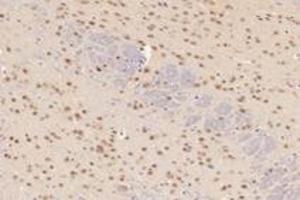 Immunohistochemistry analysis of paraffin-embedded mouse cerebellum using,TCOF1 (ABIN7076003) at dilution of 1: 2800 (TCOF1 antibody)