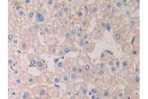 DAB staining on IHC-P; Samples: Human Liver Tissue (CrkL antibody  (AA 1-303))