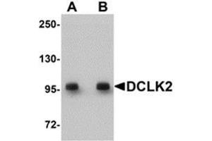 Western blot analysis of DCLK2 in rat brain tissue lysate with AP30277PU-N DCLK2 antibody at (A) 1 and (B) 2 μg/ml.