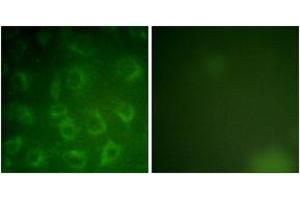 Immunofluorescence analysis of COS7 cells, using PDGFR beta (Ab-1021) Antibody. (PDGFRB antibody  (AA 991-1040))