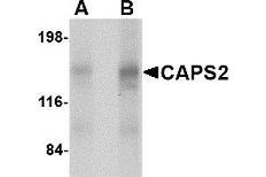 Western blot analysis of CAPS2 in human brain tissue lysate with CAPS2 antibody at (A) 0. (CADPS2 antibody  (Center))
