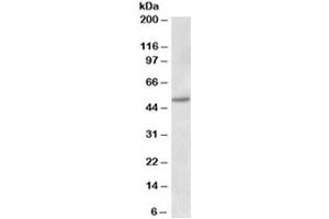 Western blot testing of human placenta lysate with Estrogen receptor beta antibody at 1ug/ml. (ESR2 antibody)