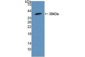 Detection of Recombinant ACTN4, Human using Polyclonal Antibody to Actinin Alpha 4 (ACTN4) (alpha Actinin 4 antibody  (AA 1-269))