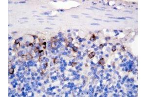 IHC-P: CD40L antibody testing of rat intestine tissue (CD40 Ligand antibody  (N-Term))