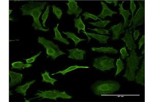 Immunofluorescence of monoclonal antibody to PPP1R1B on HeLa cell. (DARPP32 antibody  (AA 1-168))