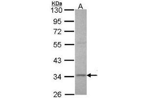 Western Blotting (WB) image for anti-X-Ray Repair Complementing Defective Repair in Chinese Hamster Cells 3 (XRCC3) (AA 202-296) antibody (ABIN615996)