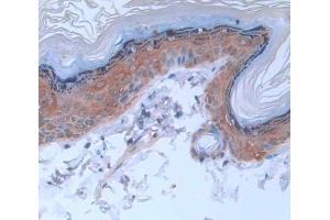 IHC-P analysis of Rat Tissue, with DAB staining. (Keratin 2 antibody  (AA 508-685))