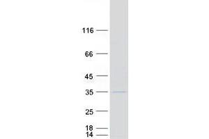 Validation with Western Blot