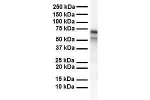 WB Suggested Anti-CES2 antibody Titration: 1 ug/mL Sample Type: Human heart (CES2 antibody  (C-Term))