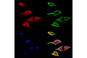 ABIN6265516 and ABIN6272982 staining Hela cells by IF/ICC.