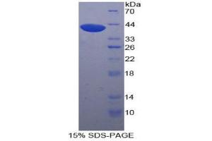 SDS-PAGE analysis of Human UGT8 Protein. (UGT8 Protein)