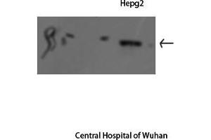 Western Blot (WB) analysis: Please contact us for more details. (STAT1 antibody  (Internal Region))