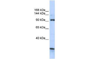 WB Suggested Anti-KIAA1024 Antibody Titration:  0.