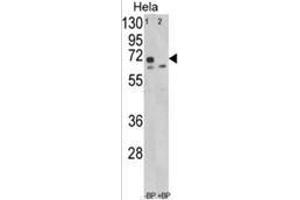 Western blot analysis of LMOD1 Antibody (Center N201) in Hela cell line lysates (35ug/lane). (Leiomodin 1 antibody  (Middle Region))