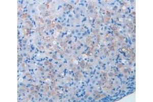 Detection of BDNF in Mouse Ovary Tissue using Polyclonal Antibody to Brain Derived Neurotrophic Factor (BDNF) (BDNF antibody  (AA 20-252))