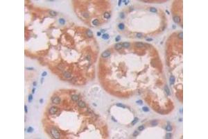 Figure. (KRT23 antibody  (AA 243-382))