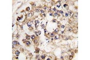 IHC analysis of FFPE human testis tissue stained with PDX1 antibody (PDX1 antibody  (AA 40-69))