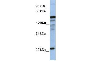 PGDS antibody used at 1 ug/ml to detect target protein.