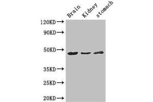 Western Blot Positive WB detected in: Mouse brain tissue, Mouse kidney tissue, Mouse stomach tissue All lanes: AGK antibody at 3 μg/mL Secondary Goat polyclonal to rabbit IgG at 1/50000 dilution Predicted band size: 48, 8 kDa Observed band size: 48 kDa (Acylglycerol Kinase antibody  (AA 32-65))