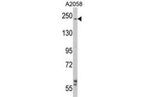Western blot analysis of LAMB2 Antibody (C-term) in A2058 cell line lysates (35ug/lane). (LAMB2 antibody  (C-Term))