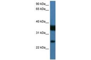 Image no. 1 for anti-Zinc Finger, Matrin Type 2 (ZMAT2) (AA 25-74) antibody (ABIN6746195) (ZMAT2 antibody  (AA 25-74))