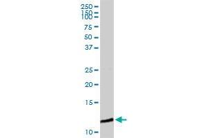 B2M MaxPab rabbit polyclonal antibody. (beta-2 Microglobulin antibody  (AA 1-119))