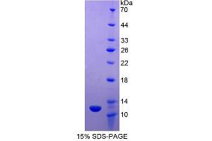Image no. 1 for Apolipoprotein C-II (APOC2) (AA 23-101) protein (His tag) (ABIN6238617) (Apolipoprotein C-II Protein (APOC2) (AA 23-101) (His tag))