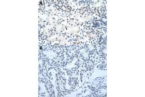 Immunohistochemical staining (Formalin-fixed paraffin-embedded sections) of human kidney (A) and human lung (B) with HNRNPH3 polyclonal antibody  at 4-8 ug/mL working concentration. (HNRNPH3 antibody  (N-Term))