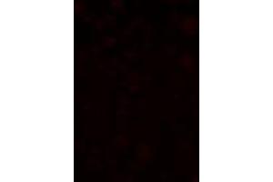 Immunofluorescence of SLAIN1 in A549 cells with SLAIN1 antibody at 2. (SLAIN1 antibody  (C-Term))