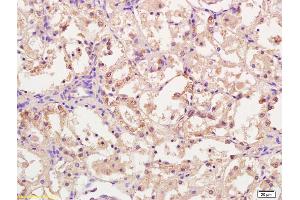 Formalin-fixed and paraffin embedded rat kidney tissue labeled with Anti-CPT1A Polyclonal Antibody, Unconjugated (ABIN677018) at 1:200, followed by conjugation to the secondary antibody and DAB staining (CPT1A antibody  (AA 1-100))