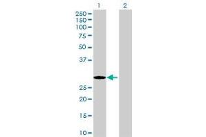 Western Blotting (WB) image for TERF2 293T Cell Transient Overexpression Lysate(Denatured) (ABIN1333695)