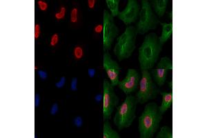 ABIN6261257 and ABIN6277502 staining  cells by IF/ICC.