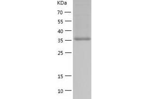 Western Blotting (WB) image for Branched Chain Amino-Acid Transaminase 2, Mitochondrial (BCAT2) (AA 28-392) protein (His tag) (ABIN7284377) (BCAT2 Protein (AA 28-392) (His tag))