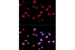 Immunofluorescent staining of U-2 OS cells with RB1 (phospho S811) polyclonal antibody  at 1:50-1:200 dilution. (Retinoblastoma 1 antibody  (pSer811))