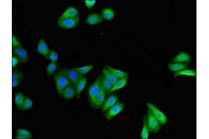 Immunofluorescent analysis of HepG2 cells using ABIN7152948 at dilution of 1:100 and Alexa Fluor 488-congugated AffiniPure Goat Anti-Rabbit IgG(H+L) (FILIP1 antibody  (AA 957-1192))