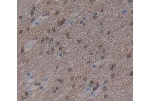#VALUE! (MYT1 antibody  (AA 903-1121))