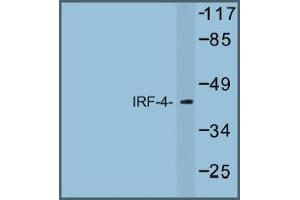 Image no. 1 for anti-Interferon Regulatory Factor 4 (IRF4) antibody (ABIN317672)