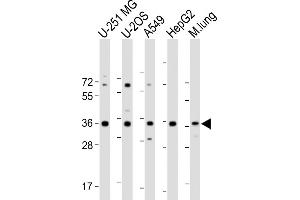 All lanes : Anti-RCN3 Antibody (Center) at 1:2000 dilution Lane 1: U-251 MG whole cell lysate Lane 2: U-2OS whole cell lysate Lane 3: A549 whole cell lysate Lane 4: HepG2 whole cell lysate Lane 5: Mouse lung lysate Lysates/proteins at 20 μg per lane. (RCN3 antibody  (AA 134-163))
