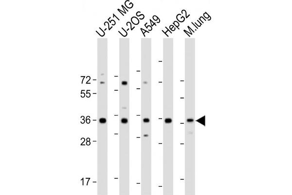 RCN3 抗体  (AA 134-163)