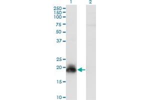 Western Blot analysis of HAND2 expression in transfected 293T cell line by HAND2 monoclonal antibody (M09), clone 2C10.
