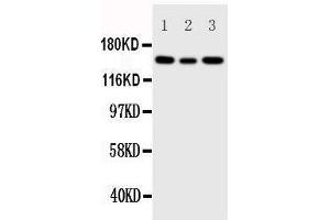 Anti-IGF1 Receptor antibody, Western blotting Lane 1: 293T Cell Lysate Lane 2: A549 Cell Lysate Lane 3: MCF-7 Cell Lysate