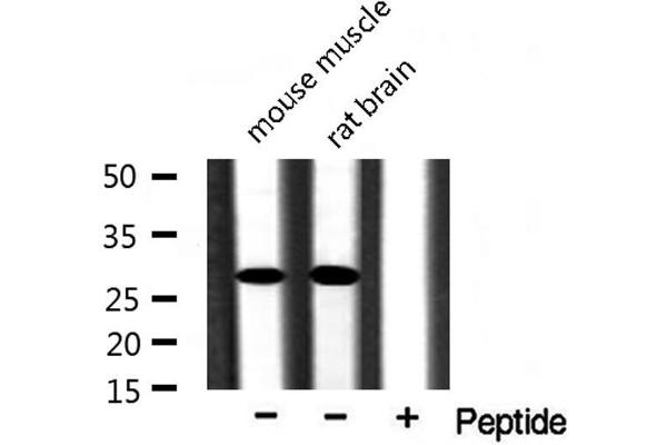 CKLF antibody