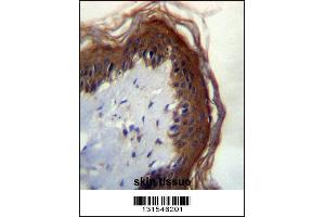 LIPM Antibdy immunohistochemistry analysis in formalin fixed and paraffin embedded human skin tissue followed by peroxidase conjugation of the secondary antibody and DAB staining. (LIPM antibody  (C-Term))
