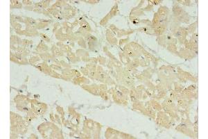 Immunohistochemistry of paraffin-embedded human heart tissue using ABIN7165422 at dilution of 1:100 (FAM156A antibody  (AA 1-153))