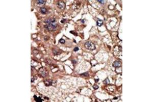 Image no. 2 for anti-Epidermal Growth Factor Receptor Pathway Substrate 8 (EPS8) (N-Term) antibody (ABIN360658) (EPS8 antibody  (N-Term))