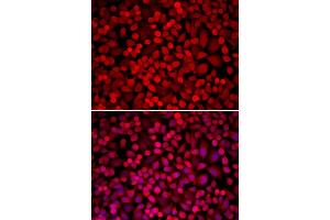 Immunofluorescence analysis of U2OS cells using NCOA1 antibody (ABIN5970476).